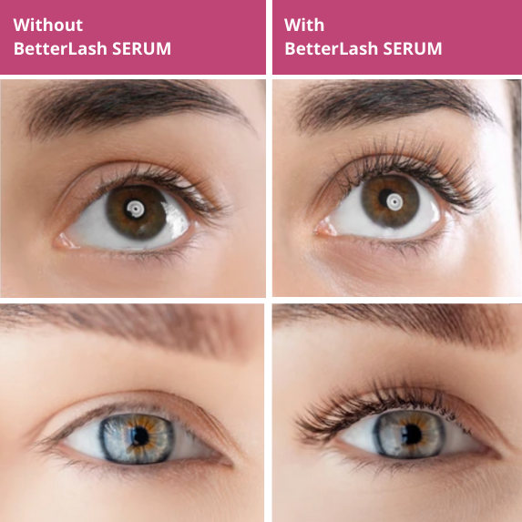 BetterLash Growth Serum